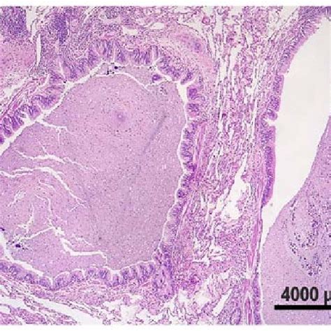 Hematoxylin And Eosin Staining Original Magnification X100