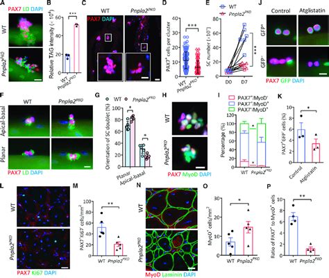 Conditional Deletion Of Atgl Leads To Abnormal Ld Accumulation And