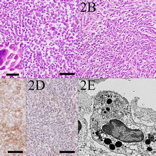 Histological Immunohistochemical And Ultrastructural Findings Of The