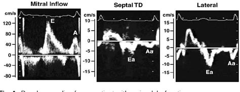 Figure 1 From Echocardiographic Assessment Of Left Ventricular