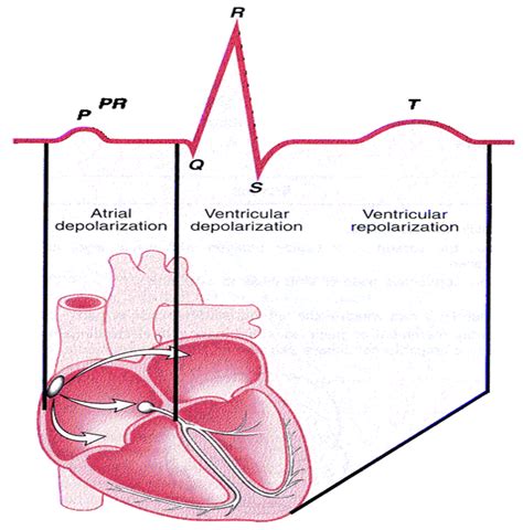 QRS Complex Wave Atrial Depolarization Qrs Complex Ventricular