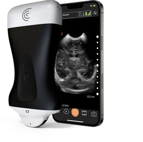 Hand Held Ultrasound System C Hd Clarius Mobile Health For