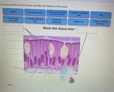 Solved Correctly Identify This Tissue Type And Label The Chegg