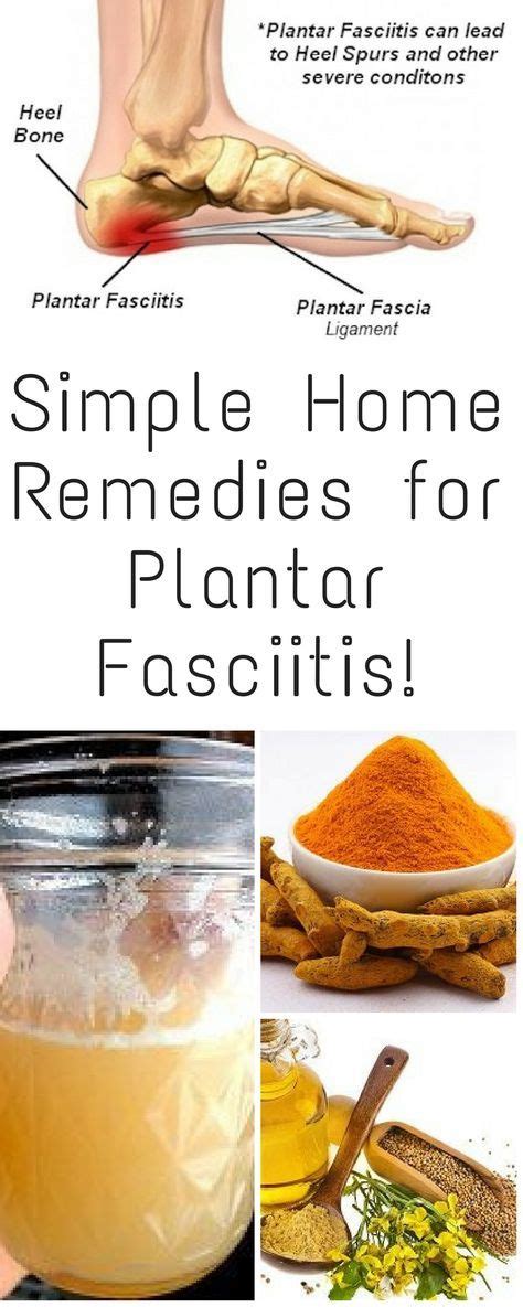 Simple Home Remedies For Plantar Fasciitis Remedies For Plantar Fasciitis Home Remedies