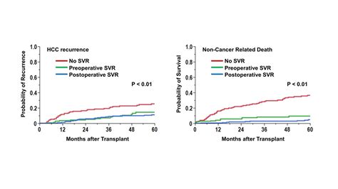 The Oncological Influences Of Pre And Post Transplant Sustained Viral Response In Liver