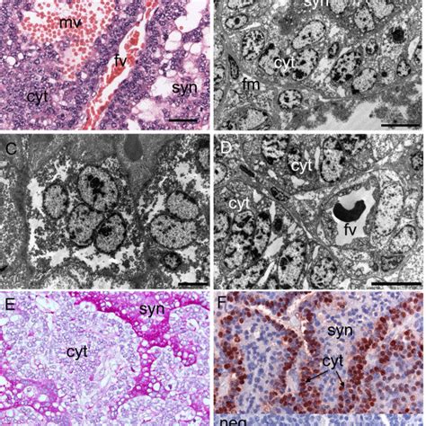 Chorioallantoic Placenta Of The Capybara At Around 90 Days Of