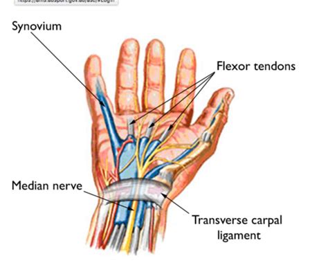 Carpal Tunnel Syndrome In A Nutshell Diagnosis And Treatment