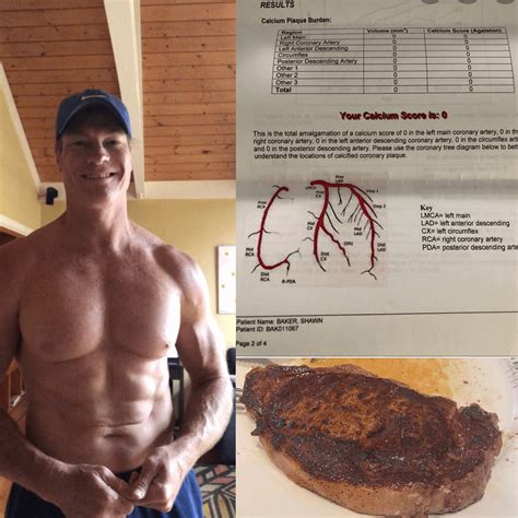 Dr Shawn Baker Carnivore For 4 Years And 54 Years Old Scores A 0 On