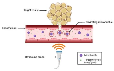 Biomedicines Free Full Text Ultrasound And Microbubbles For