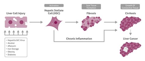 Liver Disease Proteintech Group