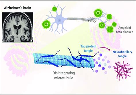 Neurofibrillary Tangles