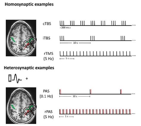 Schematic Of Transcranial Magnetic Stimulation Tms Protocols Used In