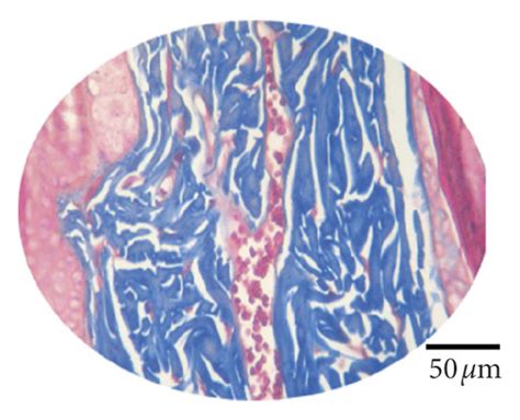 Inflammatory Infiltrate And Fibroblasts On The 9th Day After Lesion