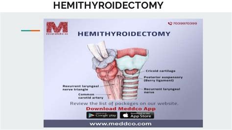 Hemithyroidectomy | PPT