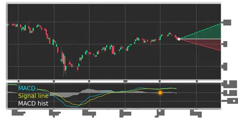 AGNC stock forecast, quote, news & analysis
