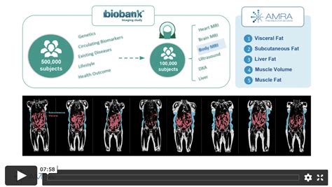 Amra Medical Research Reveals New Mri Based Data Connected To Risk For