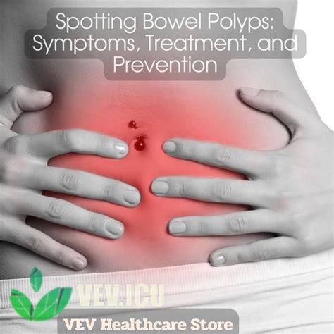 Spotting Bowel Polyps: Symptoms, Treatment, and Prevention