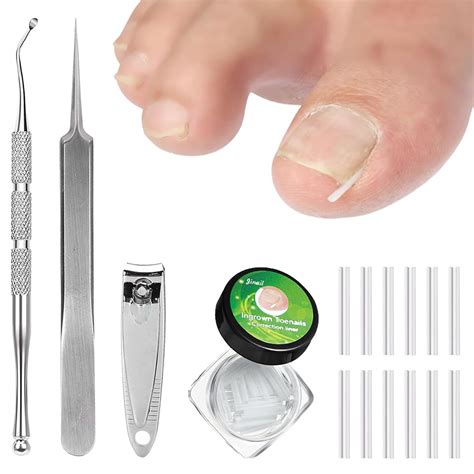 (12 +3) Ingrown Toenail Correction Treatment Kit Toenail Straightener