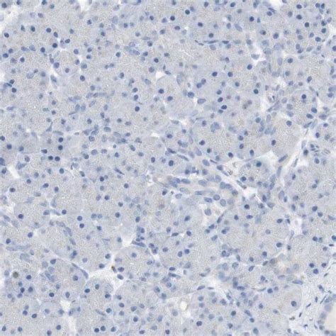 抗 CD207 兔抗Anti CD207 antibody produced in rabbit