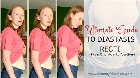 Ultimate Guide To Diastasis Recti Aka Mama Pooch Mommy Plus More