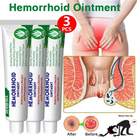 X Hemorrhoid Treatment Cream Haemorrhoids Piles Anal Fissure Prolapse Cream Gel