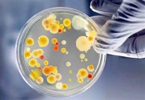 Kg Grade Standard Biotech Grade Microbial Composting Culture For