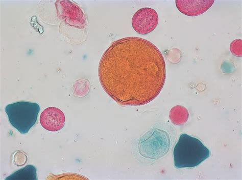 This image shows a variety of pollen types in a single image. Our ...