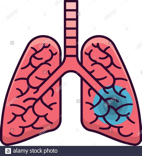 Infected Human Lungs Vector Illustration Isolated Serious Lung Disease