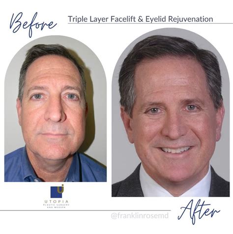 Cosmetic Surgery Blog Dr Franklin Rose Utopia MedSpa