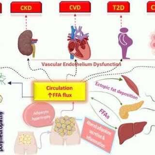 Obesity is linked to several diseases including cardiovascular disease ...