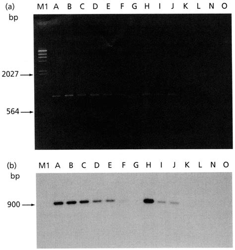 Ethidium Bromide Stained Agarose Gel A Showing Pcr