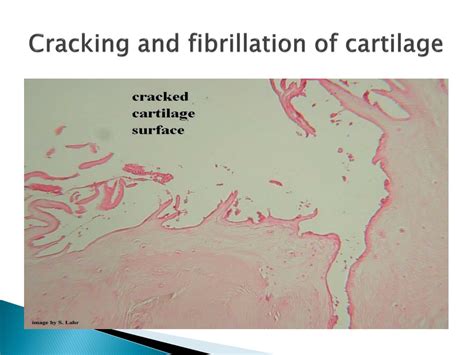 Ppt Musculoskeletal Block Pathology Disease Of Joints Powerpoint