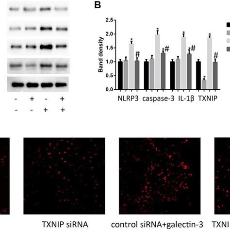 Txnip Mediated Galectin Induced Ros And Inflammation Factors