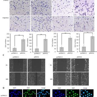 RSPO2 Promotes GBM Proliferation Migration And Invasion U87 And U251