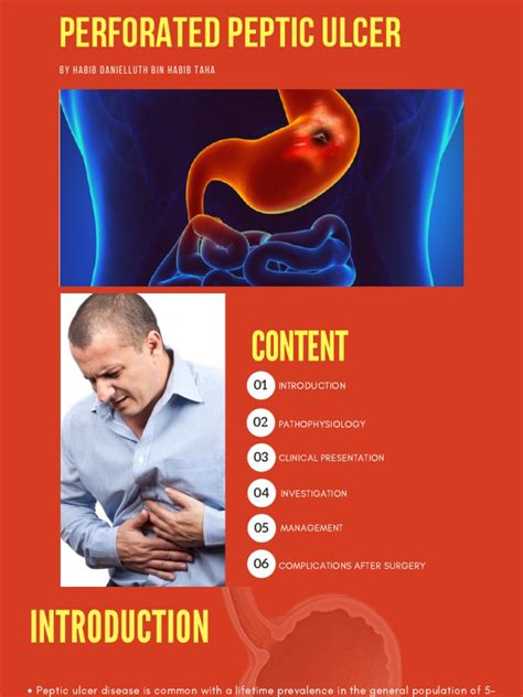 Perforated Peptic Ulcer Habib Danielluth 3 Pdf Clinical