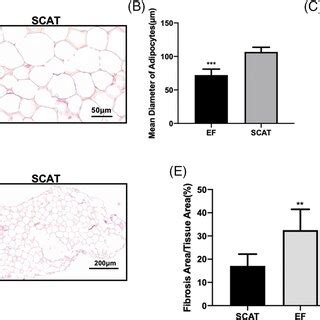 Histological Characterization Of Adipocyte Size Morphology And