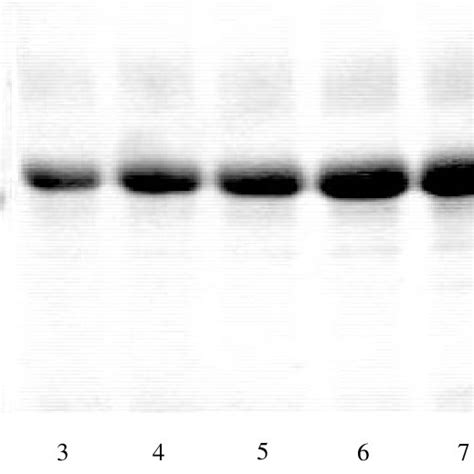 Electrophoresis On Polyacrylamide Gel Lanes 1 Standard Of Molecular Download Scientific