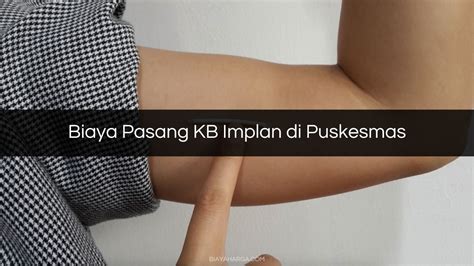 Biaya Pasang KB Implan Di Puskesmas Pasien Umum BPJS Harga Biaya