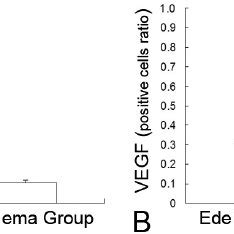 Positive Cell Fractions Of Aquaporin 4 AQP4 And Vascular Endothelial