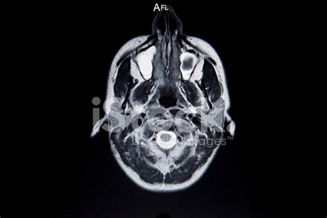 Mri Brain Scan Stock Photo | Royalty-Free | FreeImages