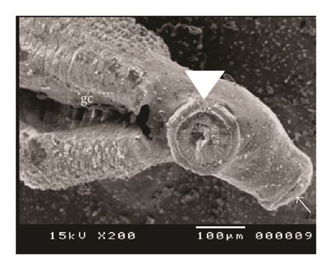 Scanning Electron Microscopy Sem Of Normal Adult S Mansoni Kept In