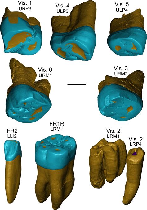 Ancient Teeth With Neanderthal Features Reveal New Chapters of Human ...