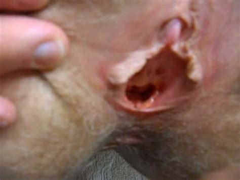 Wife S Hairy Pussy Spreading For Cum Amateur Porn Xhamster