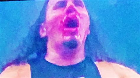 Matt Hardy Bleeding In Match With Orange Cassidy Broken Nose Aew Dynamite 8 25 21 Youtube