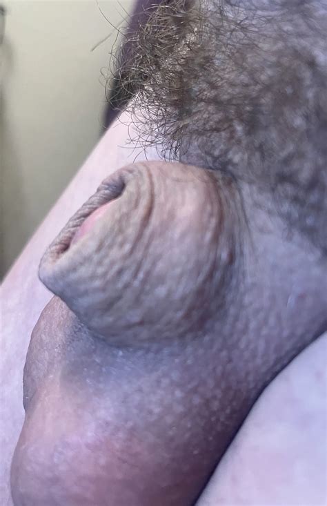 Teeny Tiny Penis Micro Cock Nude Pics Xhamster
