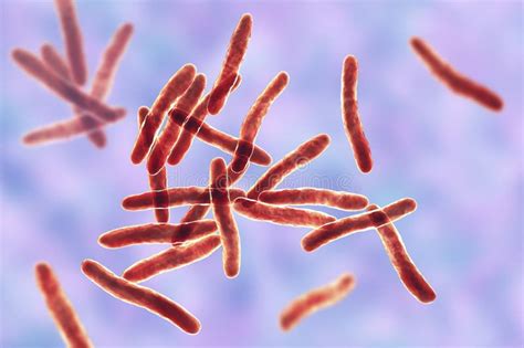 Mycobacterium Ulcerans Het Causatieve Middel Van Buruli Ulcer D