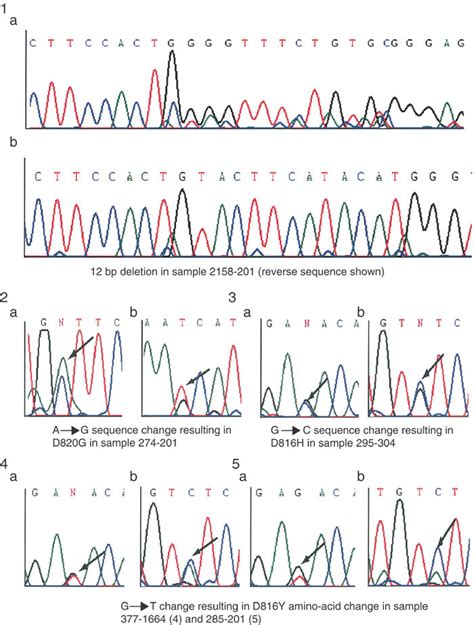 Chromatograms Showing Sequence Variants In Kit Gene Sequence In