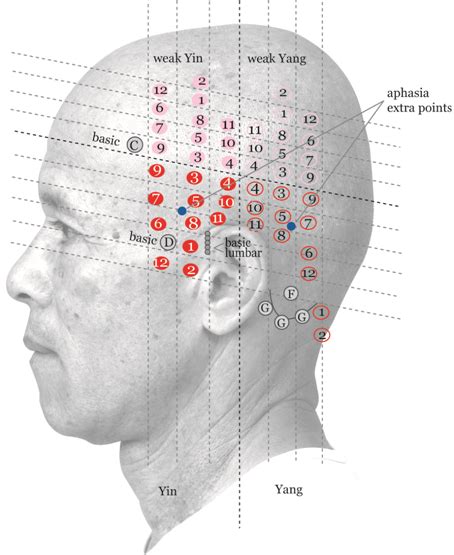 Yamamoto Scalp Acupuncture Acupuncture Benefits Acupressure Treatment Acupuncture Points Chart