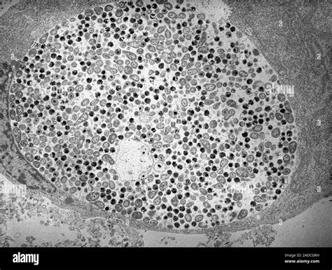 Transmission Electron Micrograph Tem Of Chlamydia Pneumoniae Bacteria