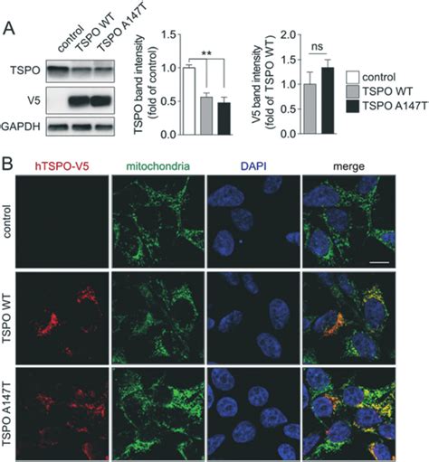 TSPO WT Or A147T Expressing Cells A Western Blotting And